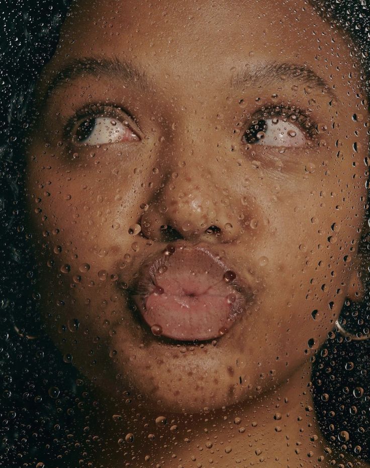 The Skin Barrier: Why It Matters & How to Strengthen It